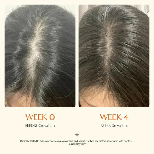 Hair GrowthSerumwith Built in Brush for Hair Growth & Thickening