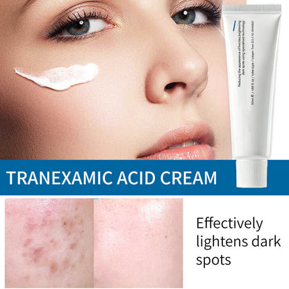 TX Tranexamic Acid Cream