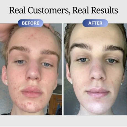 Dermaura GHK-Cu Repair