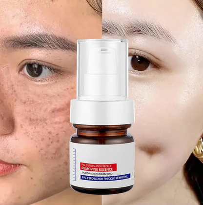 Vitamin C Whitening Freckles ESSENCE