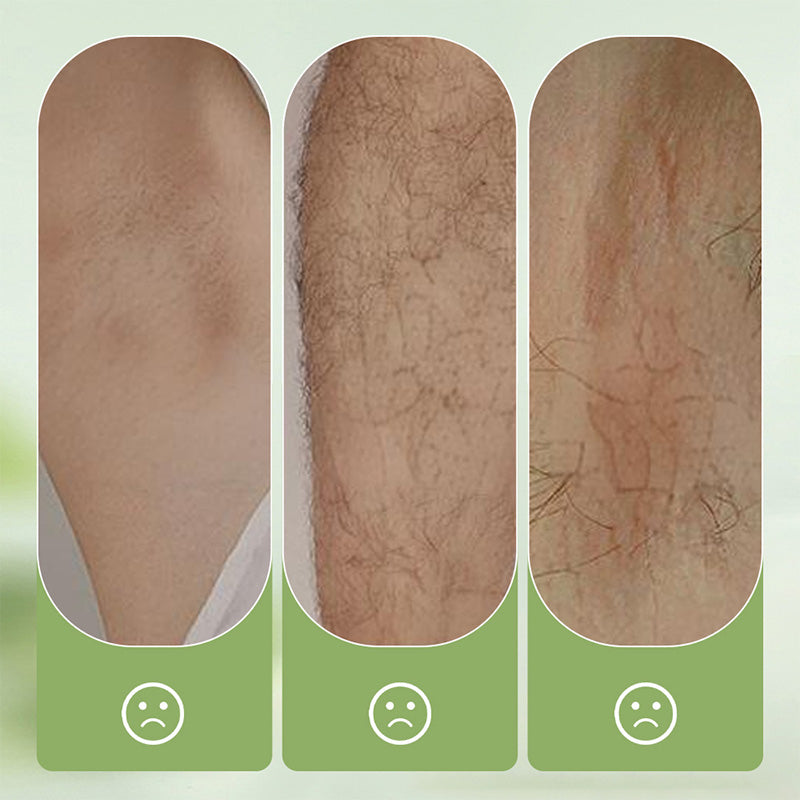 🔥Gentle and Non-Irritating Hair Removal Cream